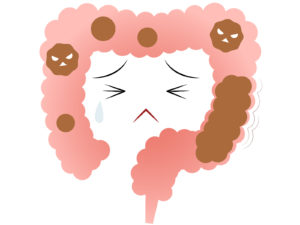 腸活ダイエットサプリ女性向け効果的なやり方徹底解説