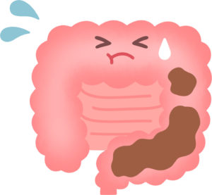 腸活ダイエットサプリ女性向け効果的なやり方徹底解説